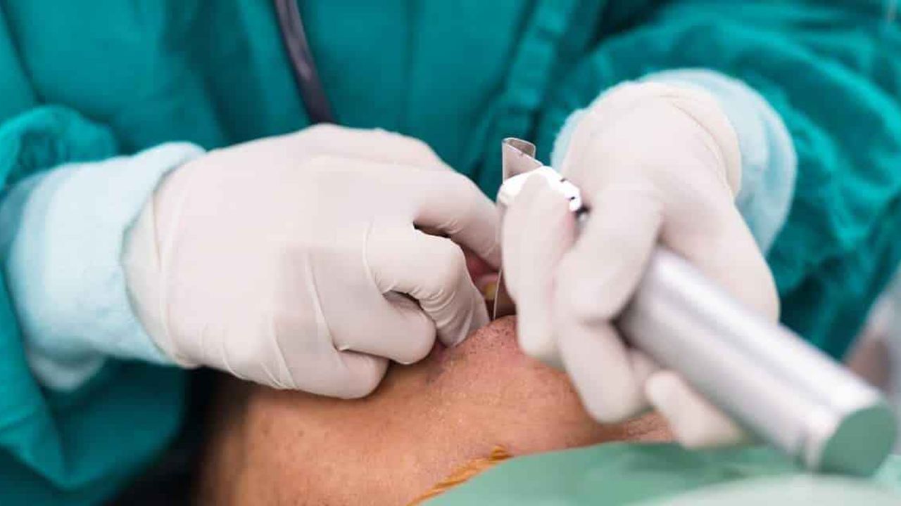 Entübe etmek ne demek? Entübasyon nasıl yapılır?