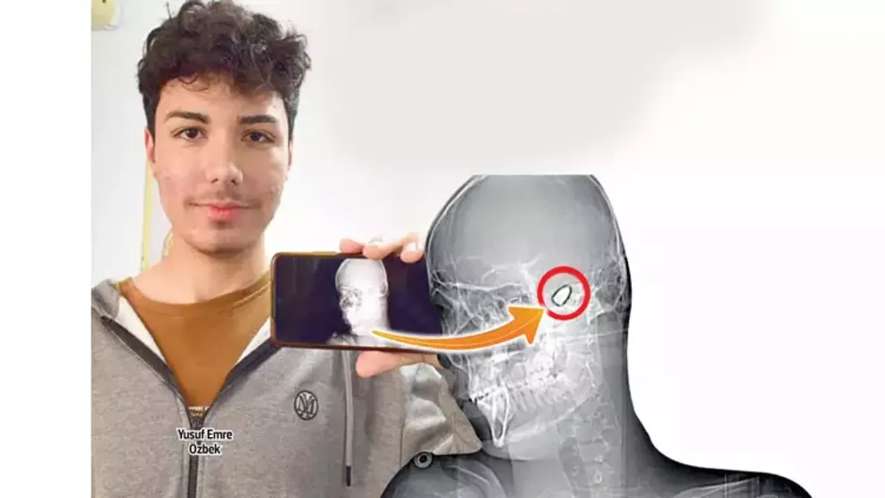 1.5 yıldır ölümle burun buruna! Kafasındaki mermi...