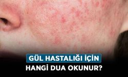 Gül hastalığı için hangi dua okunur?