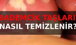 Bademcik Taşları Nasıl Temizlenir?