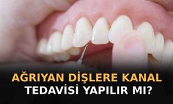 Ağrıyan Dişe Kanal Tedavisi Yapılır Mı?