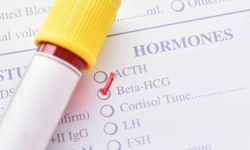 Hormon Testi Sağlık Ocağında Yapılır Mı?