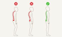 Modern yaşamın dezavantajı: Postür bozukluğu ve korunma yöntemleri