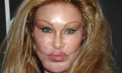 Kedi kadın Jocelyn Wildenstein hayatını kaybetti!