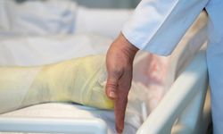 Türkiye, yanık tedavisinde kapasitesini 20 yılda katladı