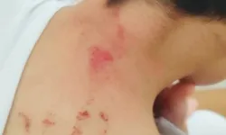 Şanlıurfa'da öğrencisini darbeden öğretmene tutuklama