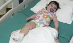 Üzerine çaydanlık devrilen 1 yaşındaki bebek dehşeti yaşadı