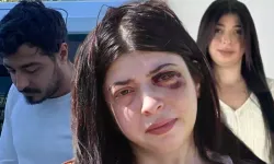 Yüzümdeki demirle sonsuza dek yaşamaya mahkum bırakıldım