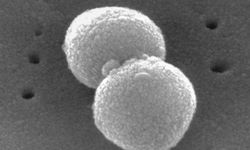 Süper bakteriye karşı geliştirilen antibiyotik, testlerin son aşamasına girdi