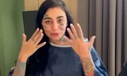 Reklam karşılığı estetik yaptırdı, öldü! Soruşturma
