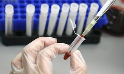HIV tedavisinde tarihi adım: Virüs hücre içinde görünür hâle getirildi