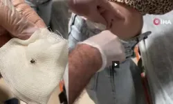 Kene kabusu Eskişehir'e sıçradı: Sırtına kene yapışan kadın hastanelik oldu