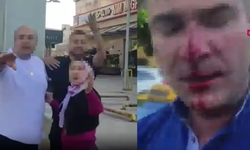 Trafik kazası kavgaya dönüştü! Çocukların önünde dövdü