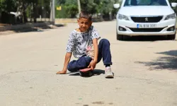 Adana'da ayağı yanlış kaynadı, hayatı mahvoldu