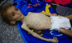 Gazze'de bir bebek daha yetersiz beslenmeden hayatını kaybetti