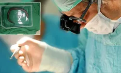 Şiddetli karın ağrısıyla hastaneye gitti; karnından canlı yılan balığı çıktı