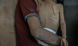 Katil İsrail'in ablukası nedeniyle Gazze'de 5 kişi daha açlıktan yaşamını yitirdi