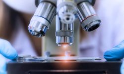 Türk bilim insanları akciğer kanserinde radyoterapiye yanıtı belirleyen 12 gen tespit etti