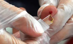 Yeni kan grubu üretiliyor: Sadece 50 kişide var