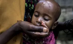 Afrika, 25 yılın en kötü kolera salgınıyla karşı karşıya