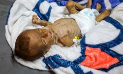 Gazze'deki hasta çocuklar, "umutsuzca" yurt dışında tedavi olacakları günü bekliyor
