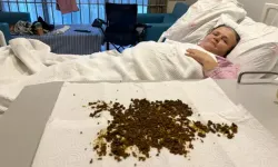 Doktorlar şaştı kaldı!  Safra kesesinden 20 binin üzerinde taş çıktı