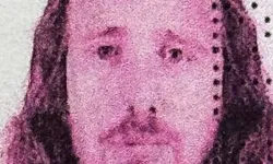 Saç ekimi ve diş tedavisi için Türkiye'ye geldi: İngiliz vatandaşı, hayatını kaybetti