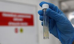 Dünyanın en ölümcül bulaşıcı hastalığı geçen yıl 1,23 milyon can aldı