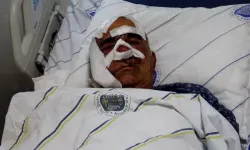 Hayvan otlatırken ayı saldırısına uğradı: Elmacık kemiği koptu!