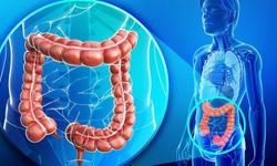 Kolon kanserine 'kolonoskopi' önerisi