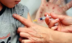 Bangladeş’te kızamık şüphesi: 113 çocuk öldü