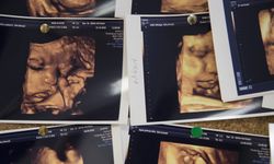 Annenin gençliğinde oluşan mutasyon bebeğinde hemofiliye yol açabiliyor