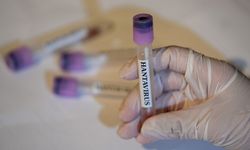 Avrupa İlaç Ajansı: Hantavirüs için onaylı tedavi ve aşı yok