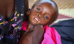 DSÖ: Sudan’da yetersiz beslenen çocuklar kolera ve kızamığa karşı daha savunmasız