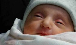 Nadir Tedaviyle Hayata Tutunan Bebek Dünyada 3. Vakaydı