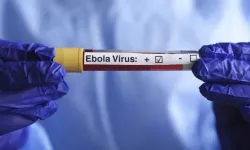 DSÖ'den Ebola salgını açıklaması: Seyahat kısıtlaması uygulanmamalı