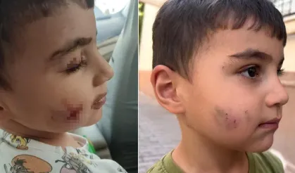 Korkunç olay! Lağım faresi uyuyan çocuğu ısırdı