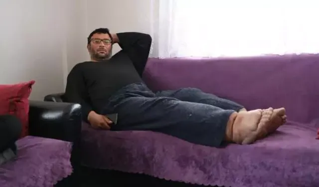 Bu hastalığın tedavisi yok! Ayakları sürekli büyüyor