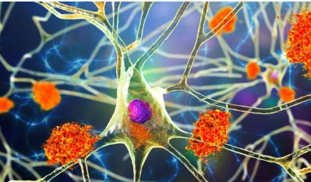 Çocuklukta bulaşan virüs, yıllar sonra Alzheimer’ı tetikliyor