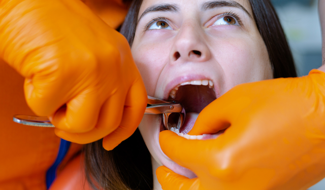 Rüyada diş çektirmek ne demek? Rüyada diş çektirmenin psikolojik anlamları nelerdir?