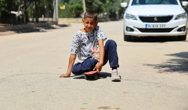 Adana'da ayağı yanlış kaynadı, hayatı mahvoldu