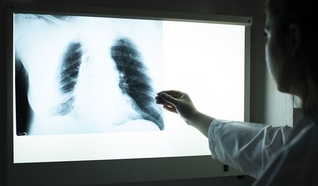 İleri evre akciğer kanserinde "yenilikçi tedavi" dönemi