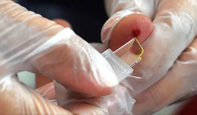 Yeni kan grubu üretiliyor: Sadece 50 kişide var