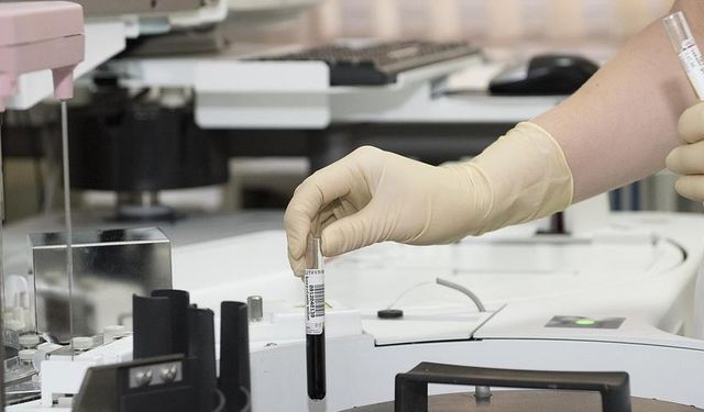 Vücutta gizlenen tümör, bağışıklık sistemini harekete geçiren "immünoterapi" ile yok ediliyor