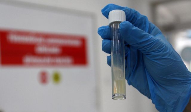 Dünyanın en ölümcül bulaşıcı hastalığı geçen yıl 1,23 milyon can aldı