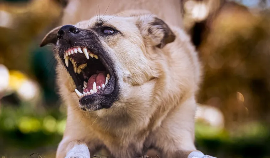 Kayseri'de sahipli köpek çocuğa saldırdı