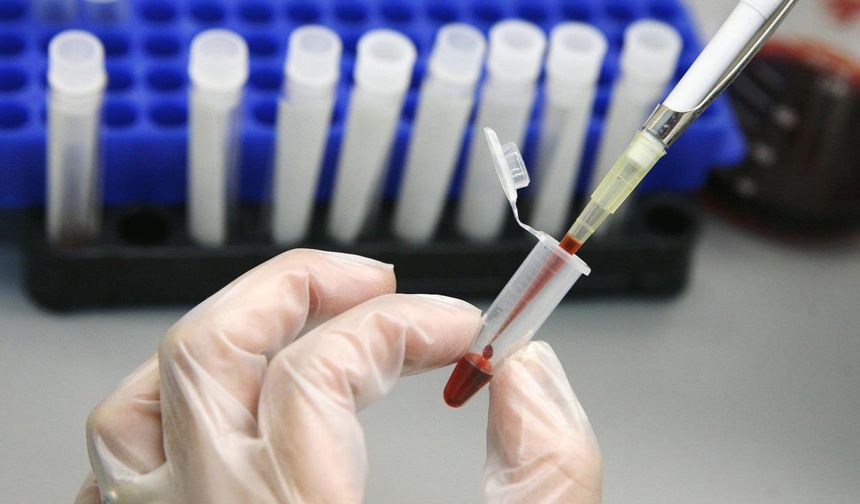 HIV tedavisinde tarihi adım: Virüs hücre içinde görünür hâle getirildi