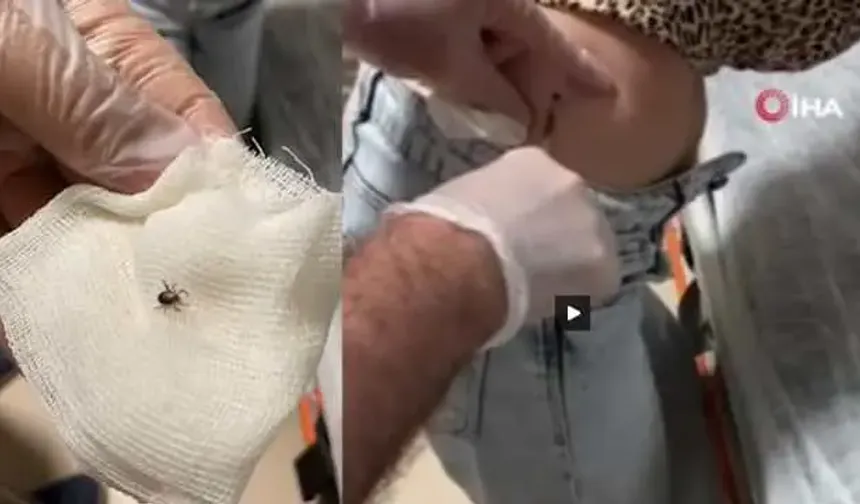 Kene kabusu Eskişehir'e sıçradı: Sırtına kene yapışan kadın hastanelik oldu