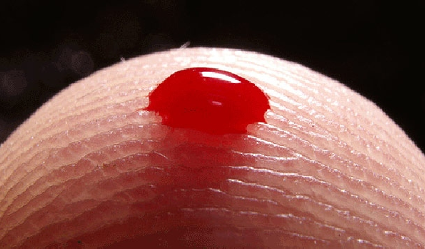 Rüyada kan görmek ne demek? Rüyada kan görmenin psikolojik anlamları...