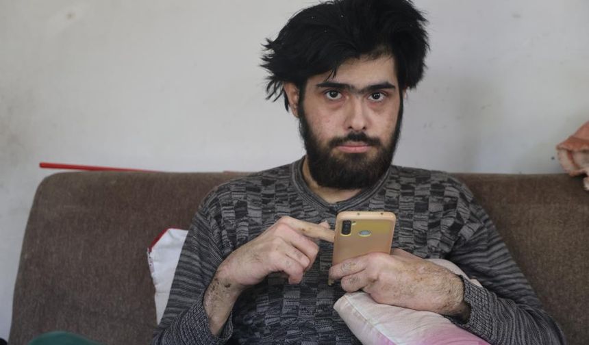 3 yıldır evden çıkmıyor, banyo yapmıyor, sadece telefon ve bilgisayarla yaşıyor